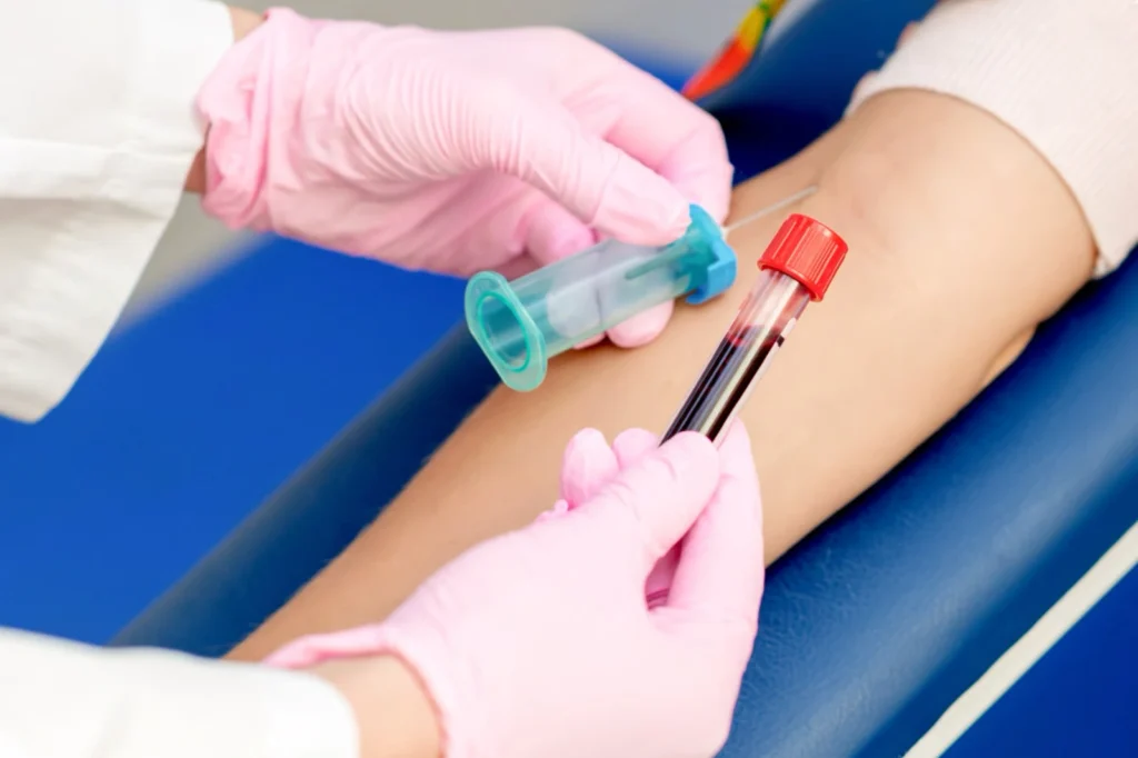 Pobieranie krwi w domu u pacjenta – dlaczego to lepsze niż wizyta w laboratorium?